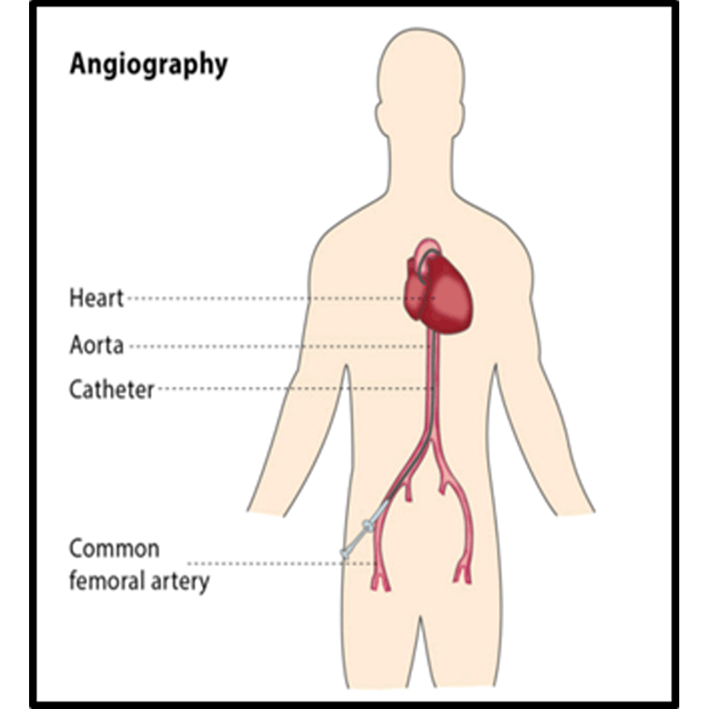 Angiography01