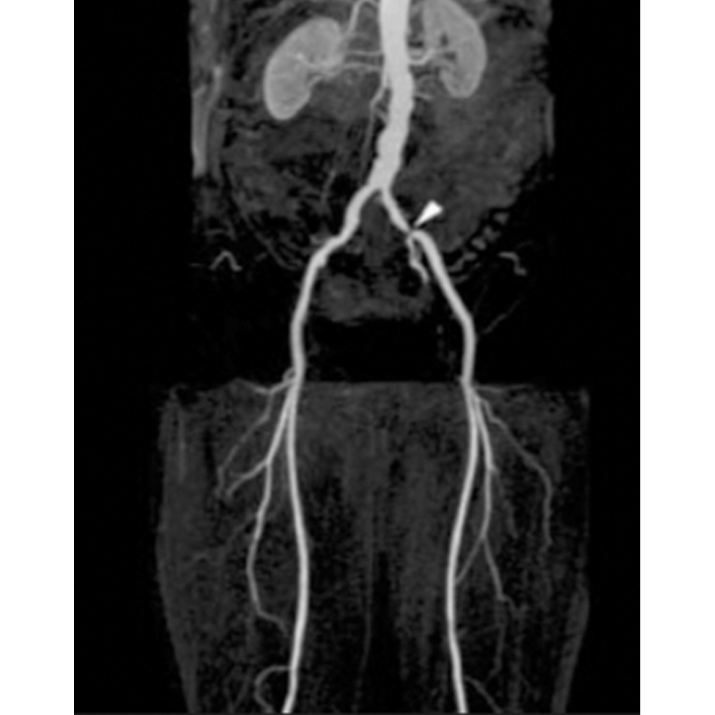 Angiography02