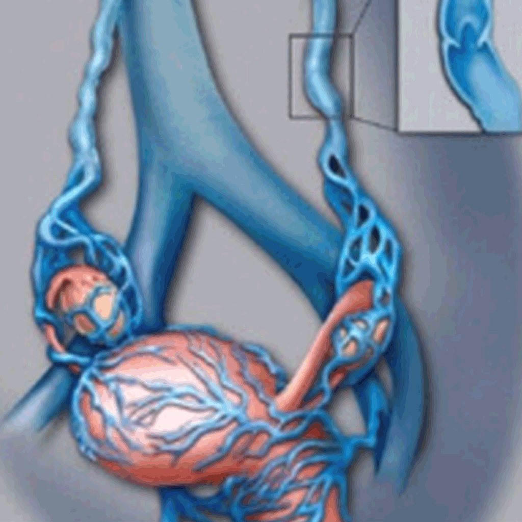EmbolisationPelvicCS01