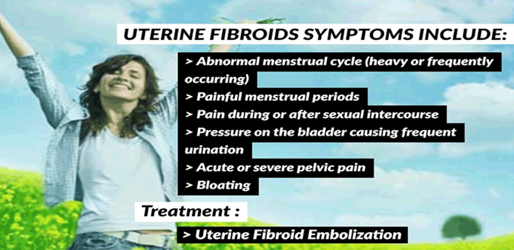 EmbolisationUterineFibroids01
