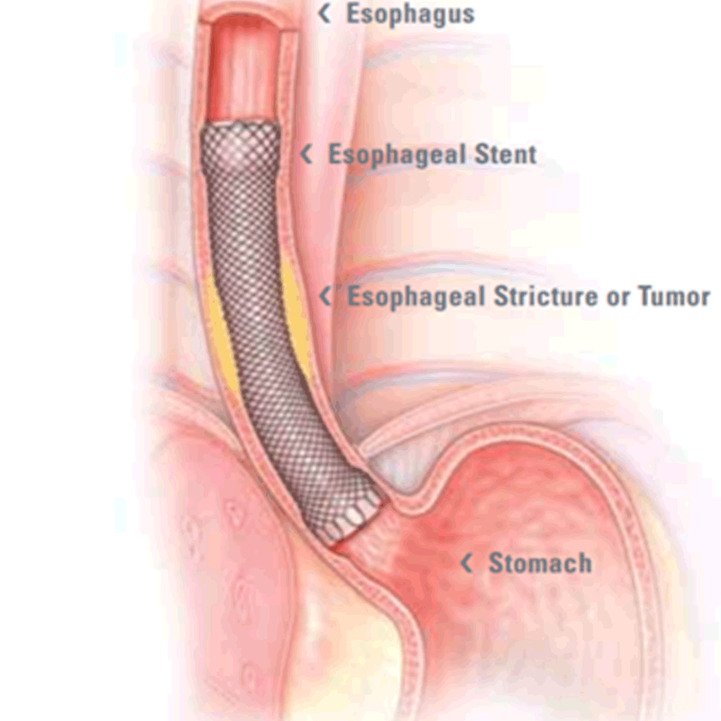 GastrointestinalOS02