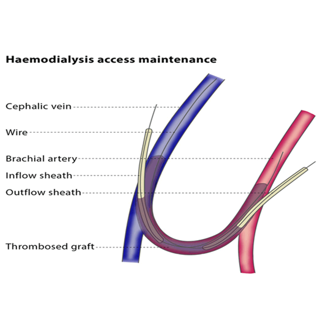 HaemodialysisAM01