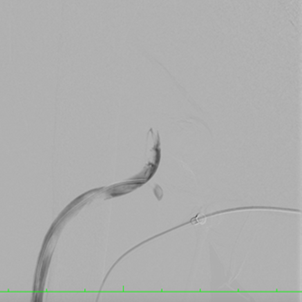 HaemodialysisAM03