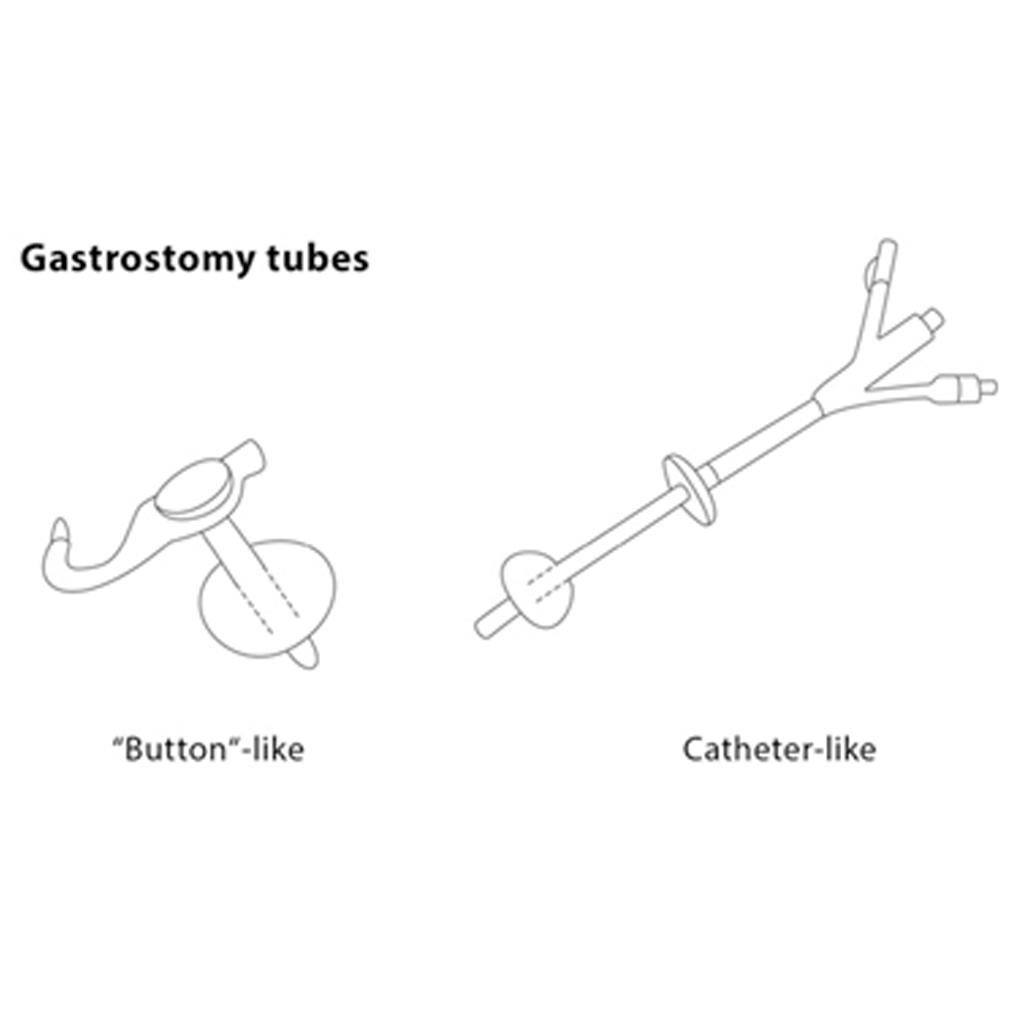gastrostomy03